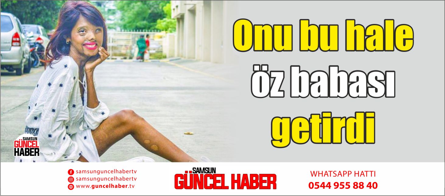 Onu bu hale öz babası getirdi